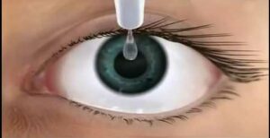 หนังตากระตุกเขม่นตา